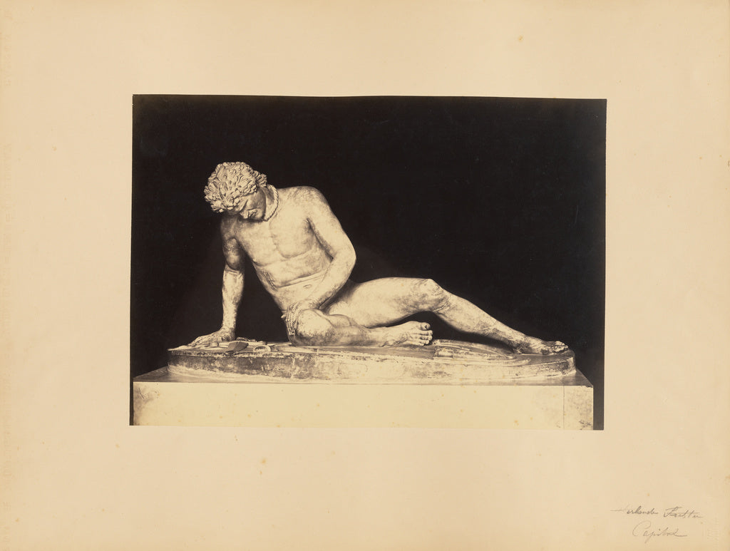 James Anderson:The Dying Gaul, Poster Print Wall Art