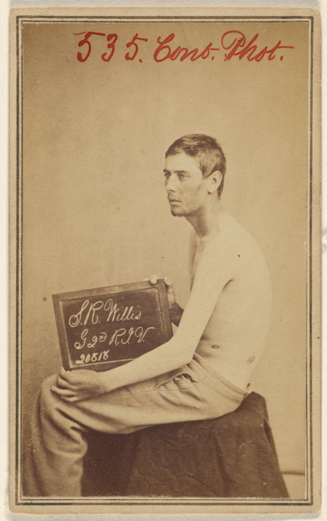 William H. BellAttributed to:[S.R. Willis, gunshot wound lef, Poster Print Wall Art