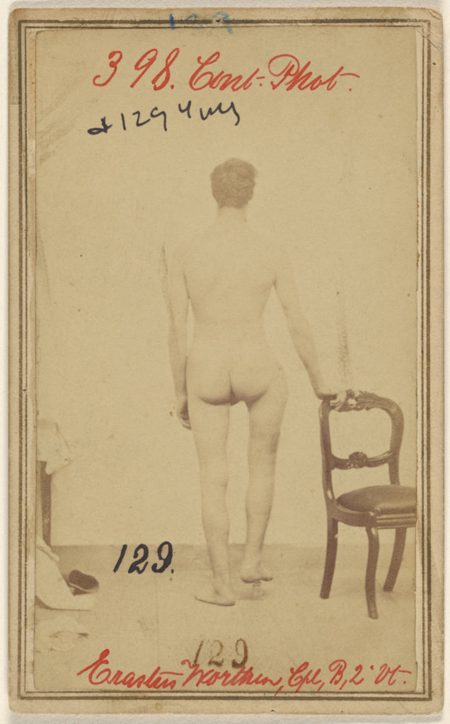 Unknown maker, American:Fracture of the upper third of the F, Poster Print Wall Art