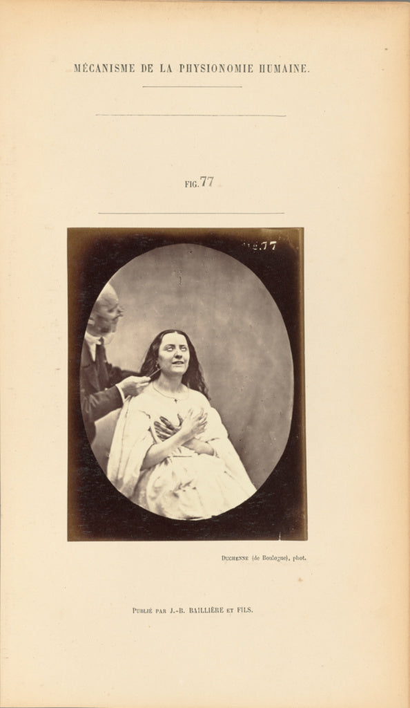 Guillaume-Benjamin Duchenne:Mécanisme de la Physionomie Hum, Poster Print Wall Art