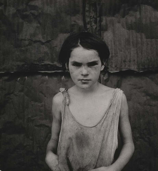 Dorothea Lange - Damaged Child Shacktown Elm Grove Oklahoma, vintage historic photograph, modern poster print