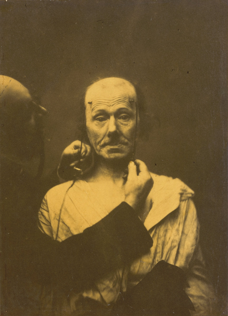 Attention by Guillaume-Benjamin-Amant Duchenne (de Boulogne) (French, 1806 - 1875), 16X12"(A3)Poster Print