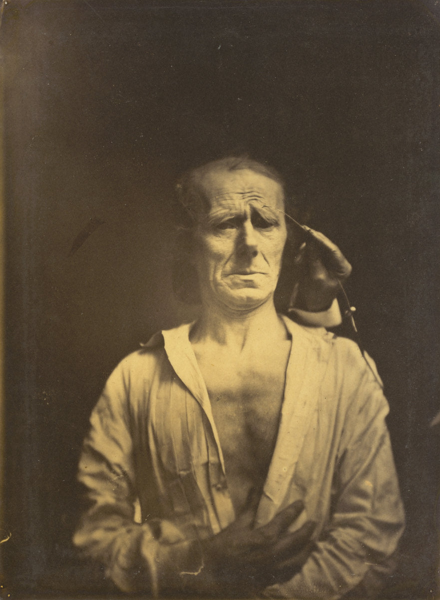 Spasm of m. corrugator supercilii under very strong light (left); A relaxed face (photographed in full sunshine) (right) by Guillaume-Benjamin-Amant Duchenne (de Boulogne) (French, 1806 - 1875), 16X12"(A3)Poster Print