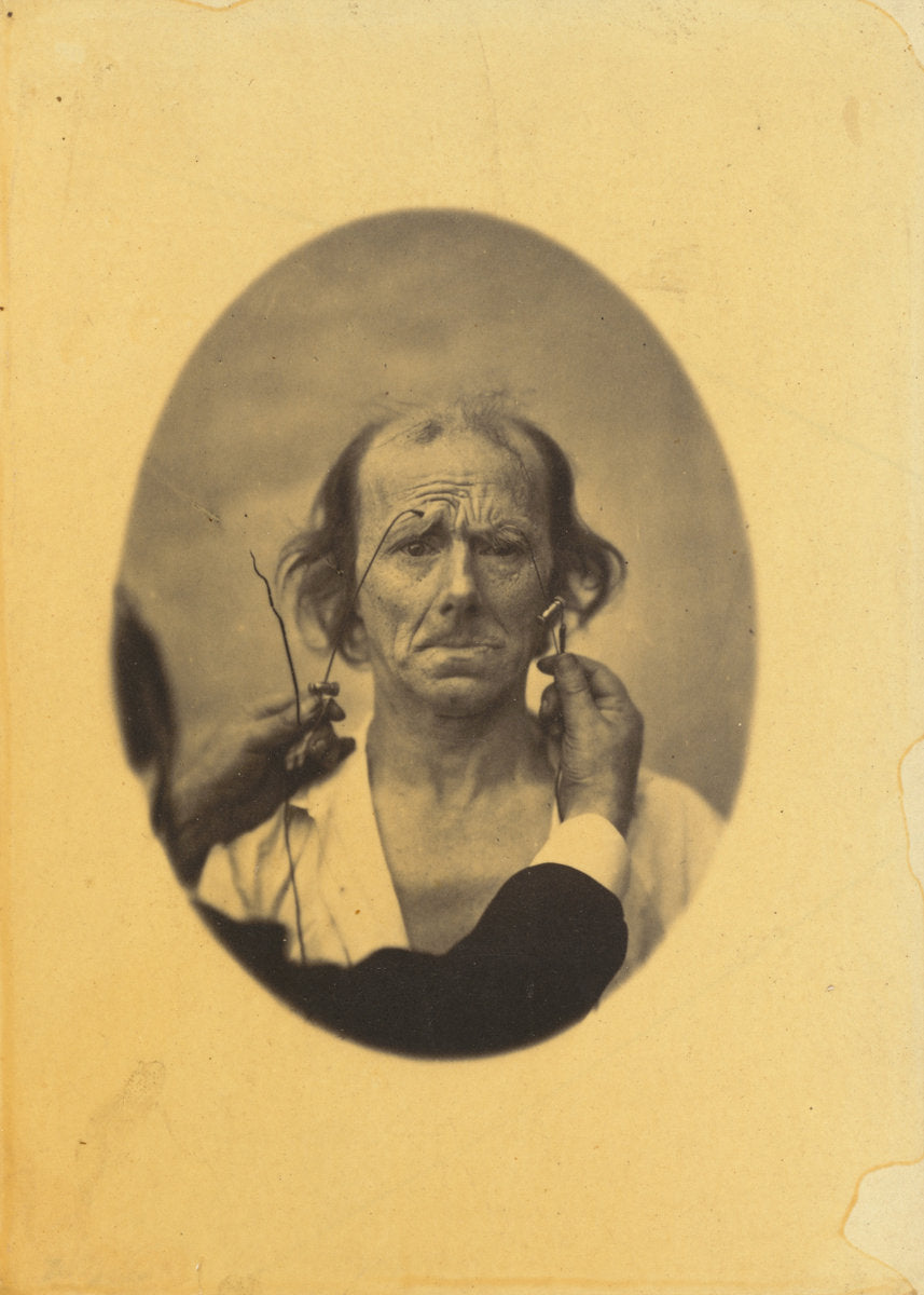 Dissatisfaction, somber thoughts (left); Reflection (right) by Guillaume-Benjamin-Amant Duchenne (de Boulogne) (French, 1806 - 1875), 16X12"(A3)Poster Print