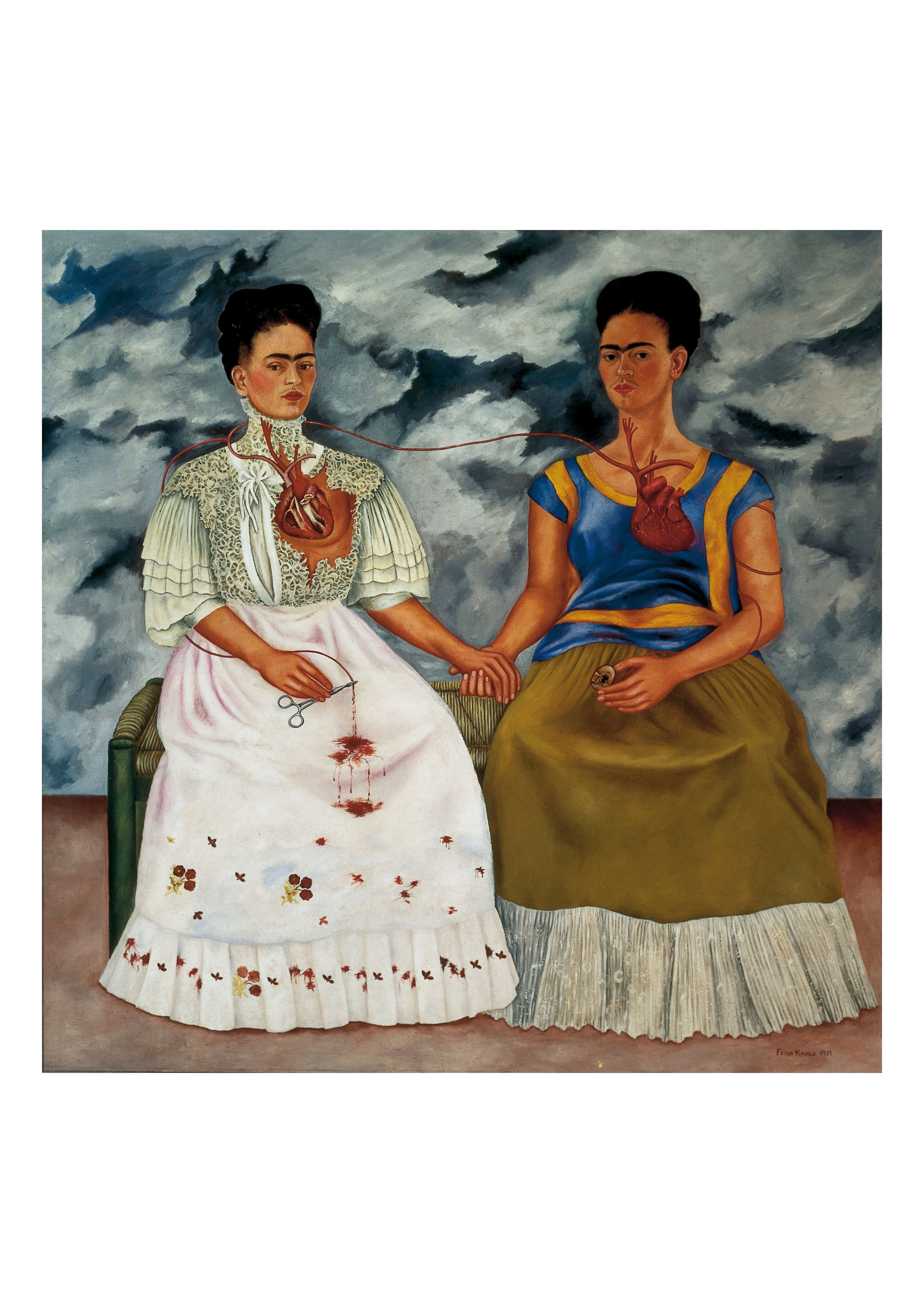 The two Fridas, Blood Transfusion, Self Portrait by Frida Kahlo, vintage art, modern poster print