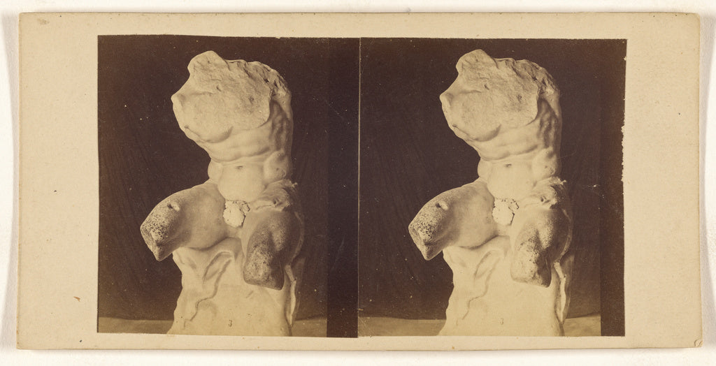 Unknown:[Sculpture fragment of male torso], Poster Print Wall Art