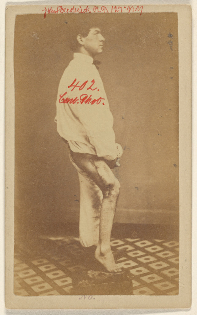 William H. BellAttributed to:No. 2. Case of John Frederick U, Poster Print Wall Art