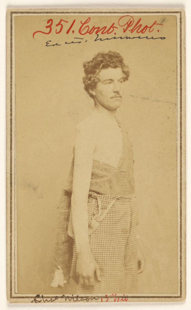 Baldwin & Prior:Chas. Wilson [Civil War victim], Poster Print Wall Art