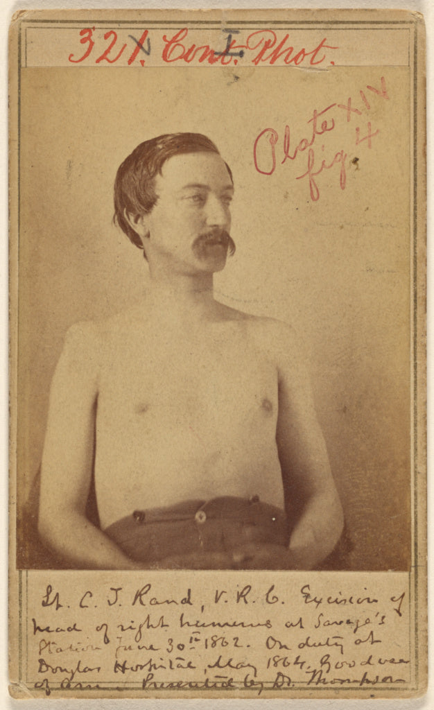W. Thompson:[Lt. C.T. Rand, V.R.G., Civil War victim], Poster Print Wall Art