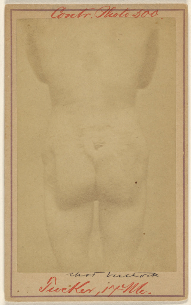 Unknown maker, American:[Jno. E. Tucker, shot in the buttock, Poster Print Wall Art