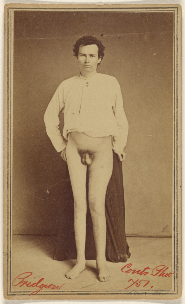 Unknown maker, American:[Pridgeon, Civil War victim], Poster Print Wall Art