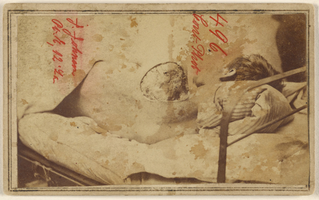 Unknown maker, American:[Joseph Johnson, Civil War victim], Poster Print Wall Art