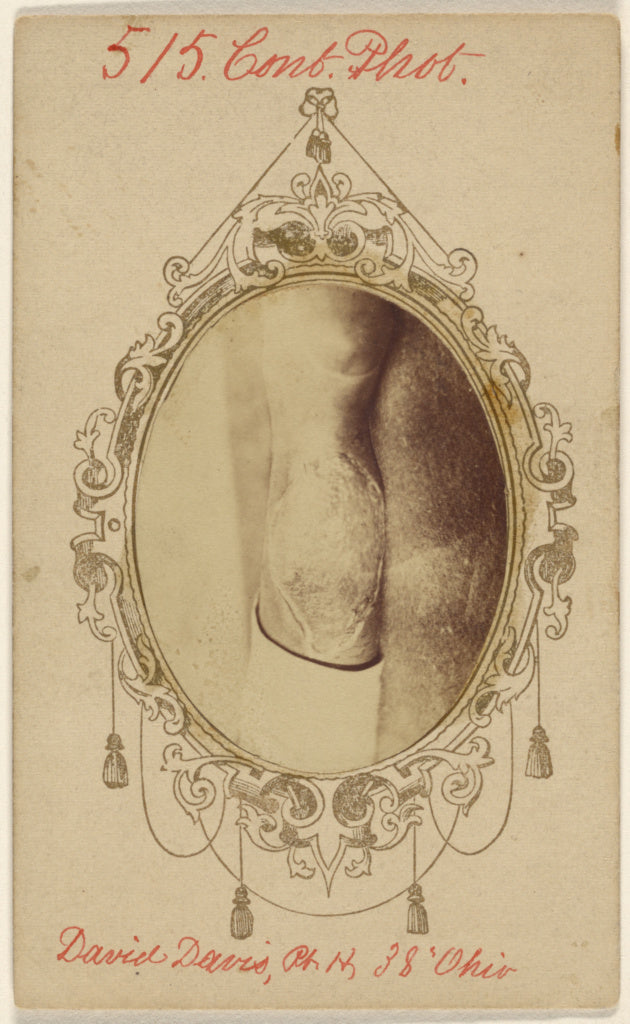 Unknown maker, American:[David Davis, private, Civil War vic, Poster Print Wall Art