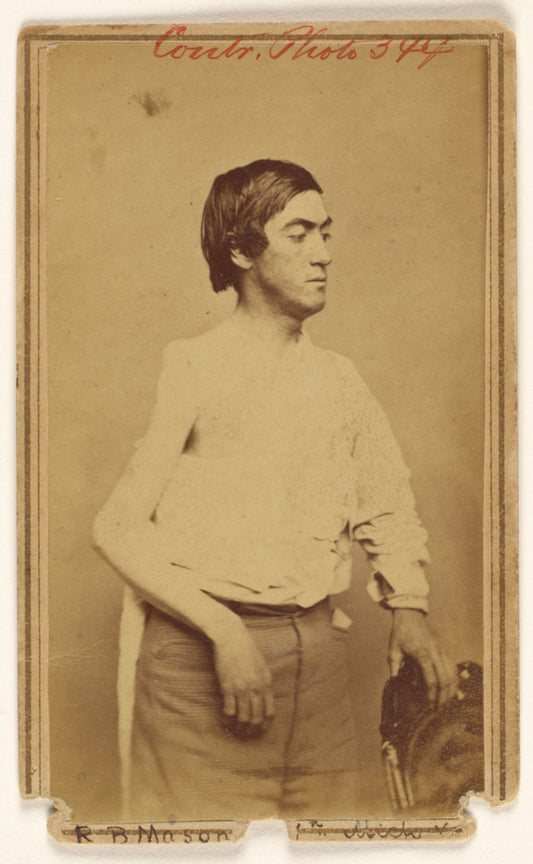 Baldwin & Prior:[Russell B. Mason, Civil War victim],16x12"(A3)Poster