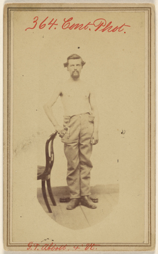 Unknown maker, American:[George T. Abbot, False joint of the, Poster Print Wall Art