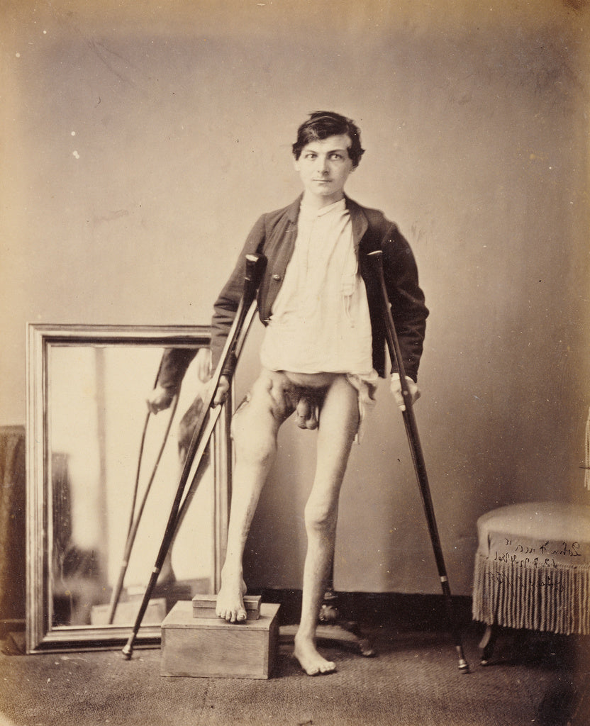 William H. BellPossibly:Gunshot Fracture of the Shaft of the, Poster Print Wall Art