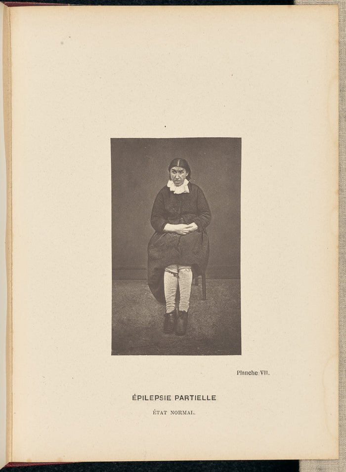 André Adolphe-Eugène Disdéri:Epilepsie Partielle etat Normal,16x12