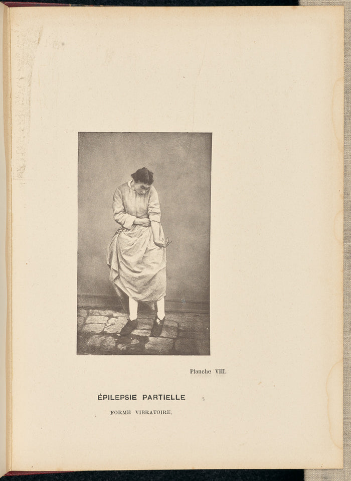 André Adolphe-Eugène Disdéri:Epilepsie Partielle Forme Vibra,16x12