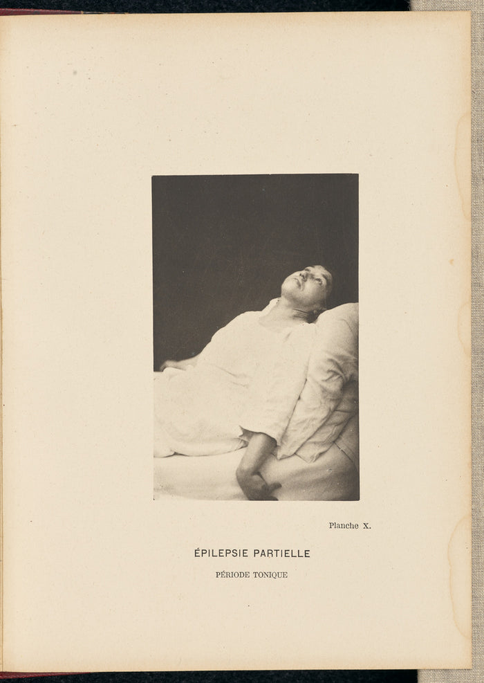 André Adolphe-Eugène Disdéri:Epilepsie Partielle Période To,16x12