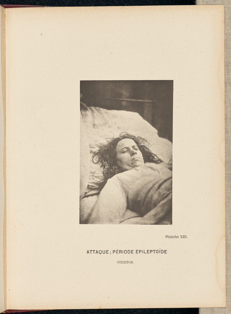 Paul-Marie-Léon Regnard:Attaque; Période epileptoïde Ster, Poster Print Wall Art