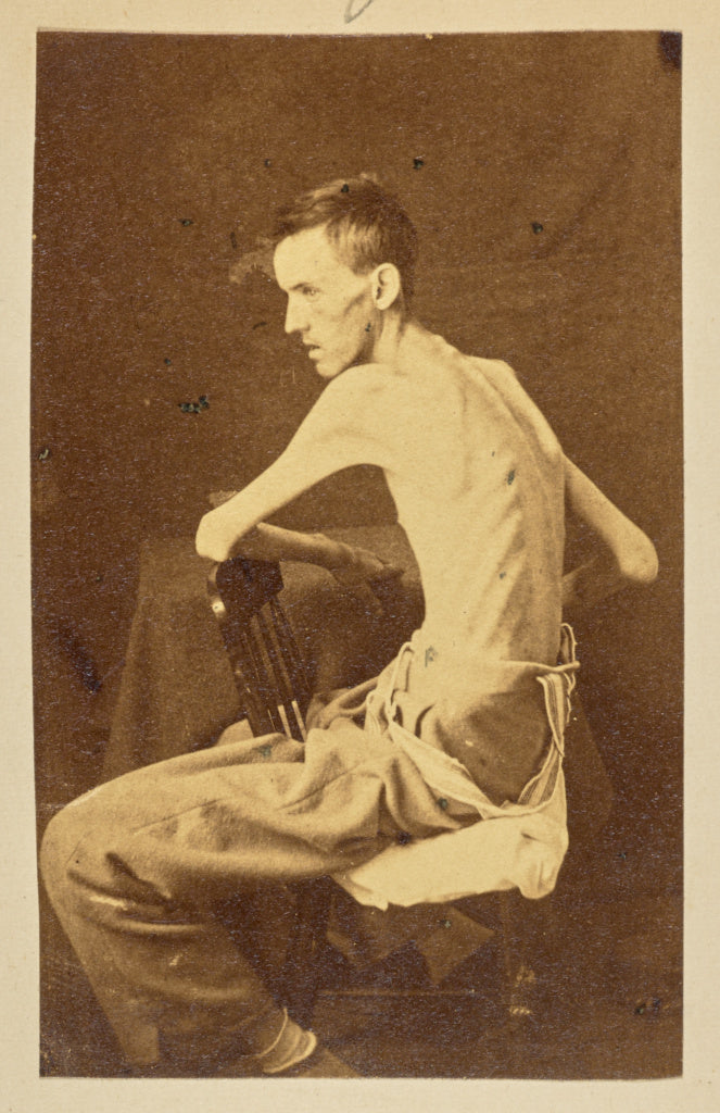 Unknown:[Private Jackson O. Broshers], Poster Print Wall Art