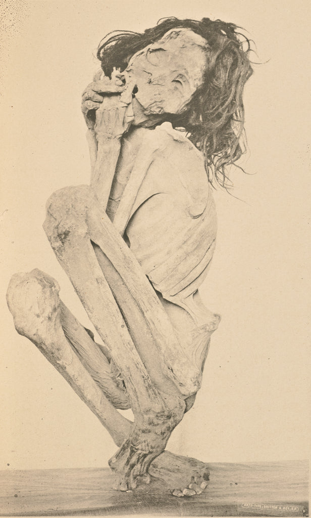 Winfield S. Keyes:[Remains of a Woman], Poster Print Wall Art