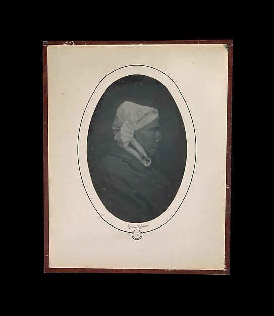 Louis-Auguste Bisson:[Profile of a Woman with Necrosis of th-16x12"(A3) Poster