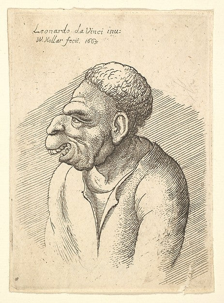 Bust of a manwith hooked nose  prominent upper lip  open mouth,  Poster Print Wall Art
