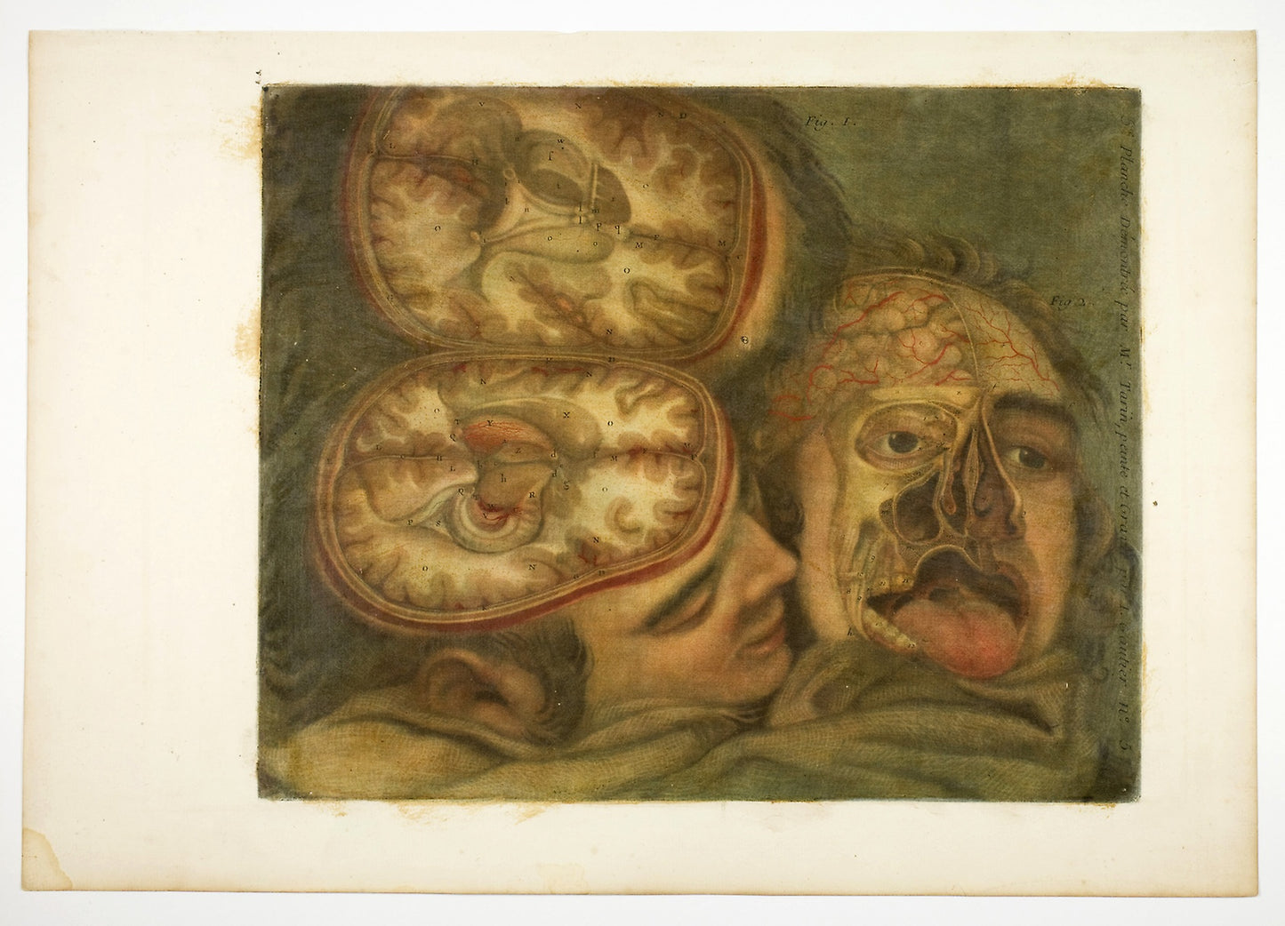 Cranial Dissection, plate five from Anatomy of the Head, in Printed Paintings -  Jacques Fabien Gautier D'Agoty,  Poster Print Wall Art