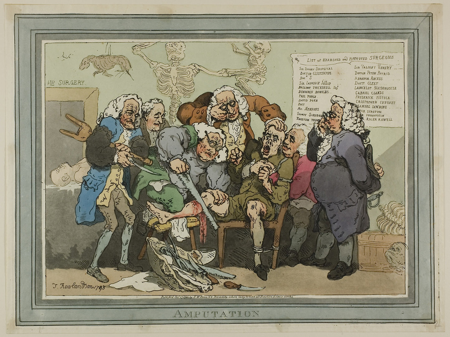 Amputation -  Thomas Rowlandson (English, 1756-1827),  Poster Print Wall Art