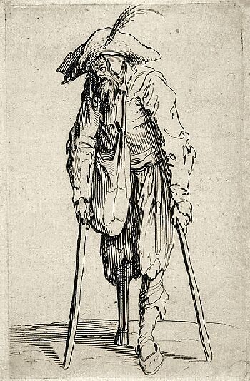 The Beggars ~ The Beggar with the Wooden Leg, vintage artwork by Jacques Callot, 12x8" (A4) Poster