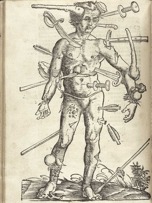 Field book of surgery. The wounded man, vintage artwork by Hans Wechtlin, A3 (16x12") Poster Print