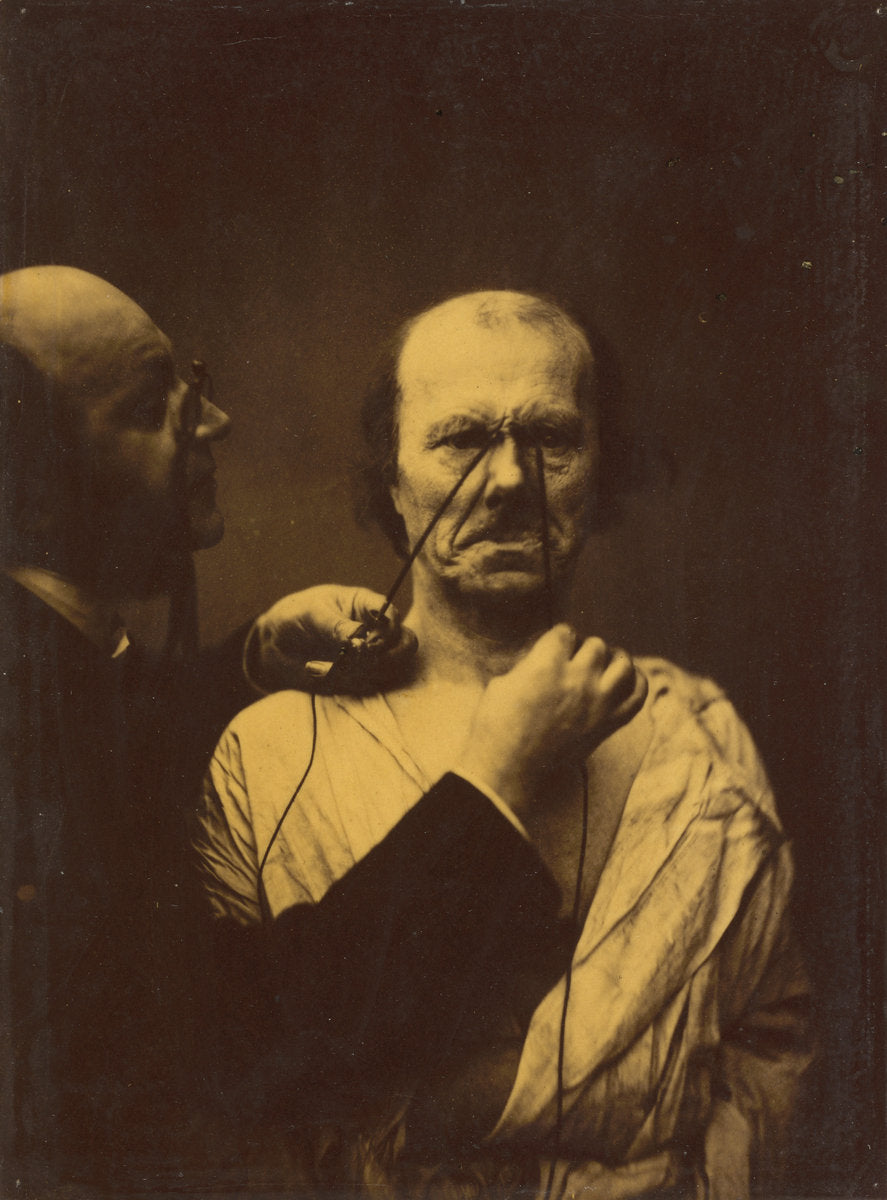 Aggression, wickedness by Guillaume-Benjamin-Amant Duchenne (de Boulogne) (French, 1806 - 1875), 16X12"(A3)Poster Print