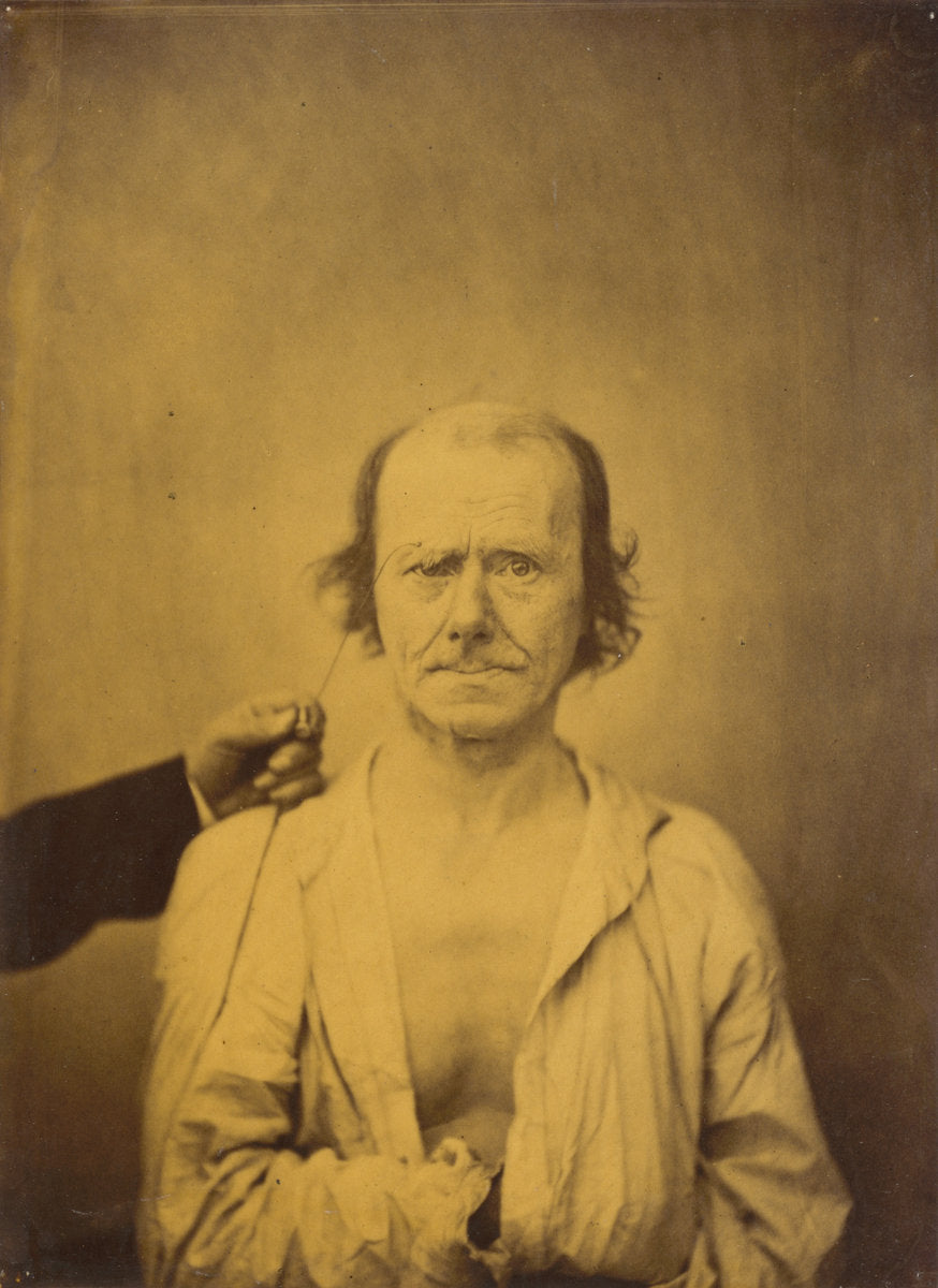 Attention (left); Reflection (right) by Guillaume-Benjamin-Amant Duchenne (de Boulogne) (French, 1806 - 1875), 16X12"(A3)Poster Print