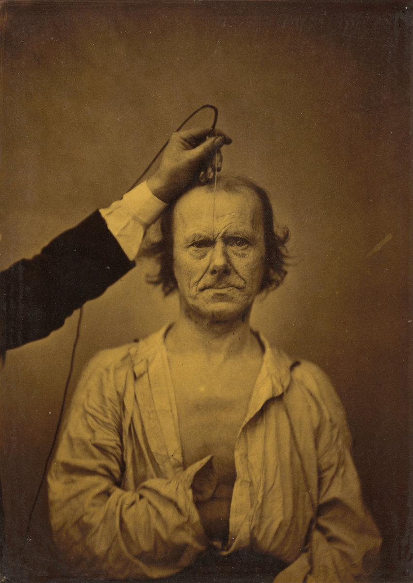 Attention (left); Severity, aggression (right) by Guillaume-Benjamin-Amant Duchenne (de Boulogne) (French, 1806 - 1875), 16X12"(A3)Poster Print