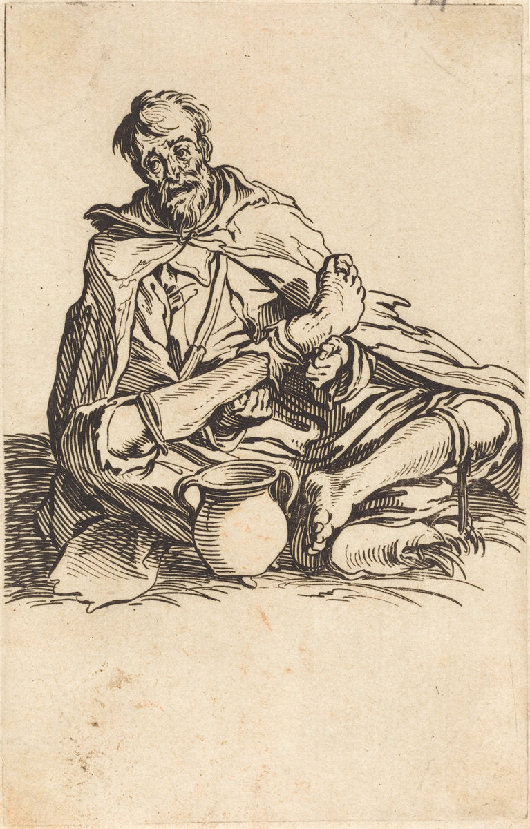 The Sick Man by Jacques Callot (French, 1592 - 1635), 16X12"(A3)Poster Print