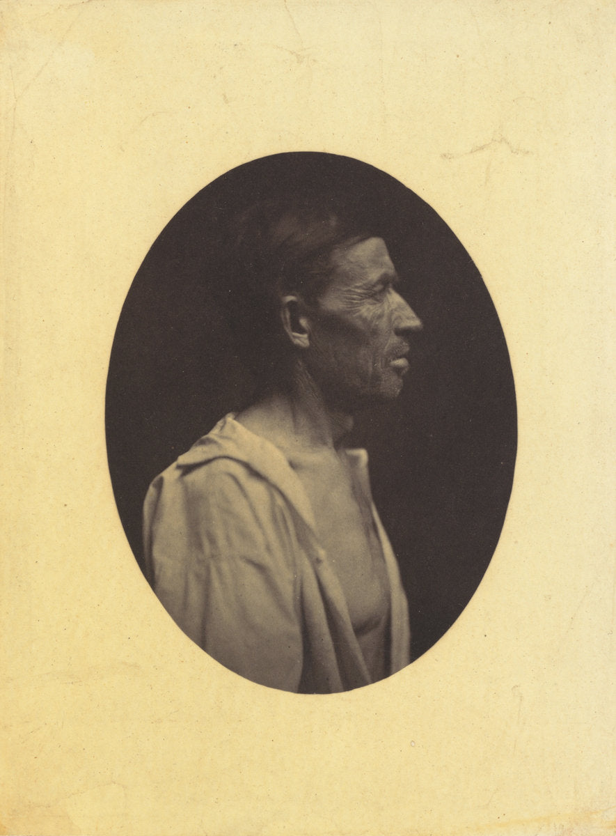 A portrait, seen in profile, of a man 42 years old, stupefied by the abuse of alcohol; his nose is aquiline by Guillaume-Benjamin-Amant Duchenne (de Boulogne) (French, 1806 - 1875), 16X12"(A3)Poster Print