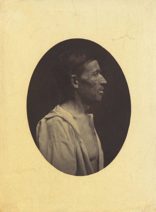 A portrait, seen in profile, of a man 42 years old, stupefied by the abuse of alcohol; his nose is aquiline by Guillaume-Benjamin-Amant Duchenne (de Boulogne) (French, 1806 - 1875), 16X12"(A3)Poster Print