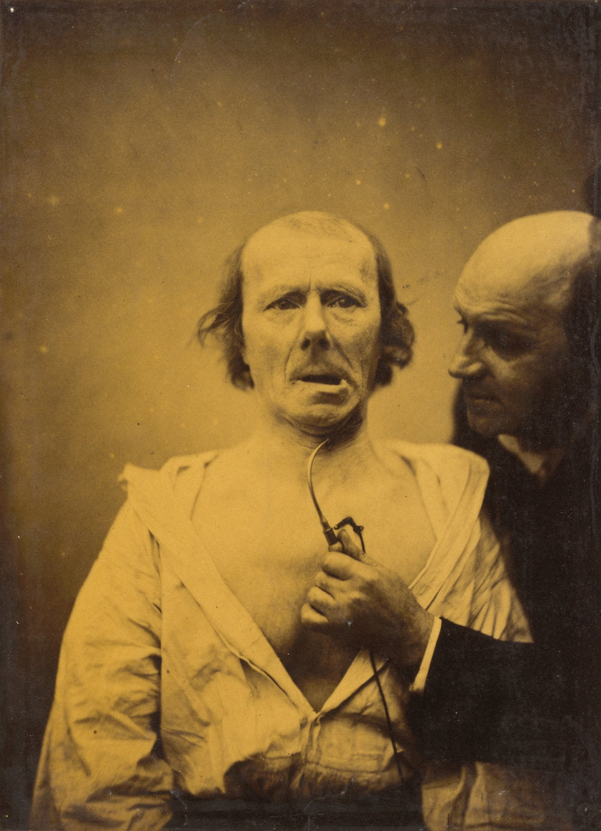This contraction of m. platysma alone lacks expression by Guillaume-Benjamin-Amant Duchenne (de Boulogne) (French, 1806 - 1875), 16X12"(A3)Poster Print