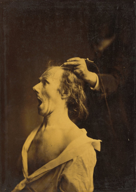 Astonishment, stupefaction, amazement by Guillaume-Benjamin-Amant Duchenne (de Boulogne) (French, 1806 - 1875), 16X12"(A3)Poster Print