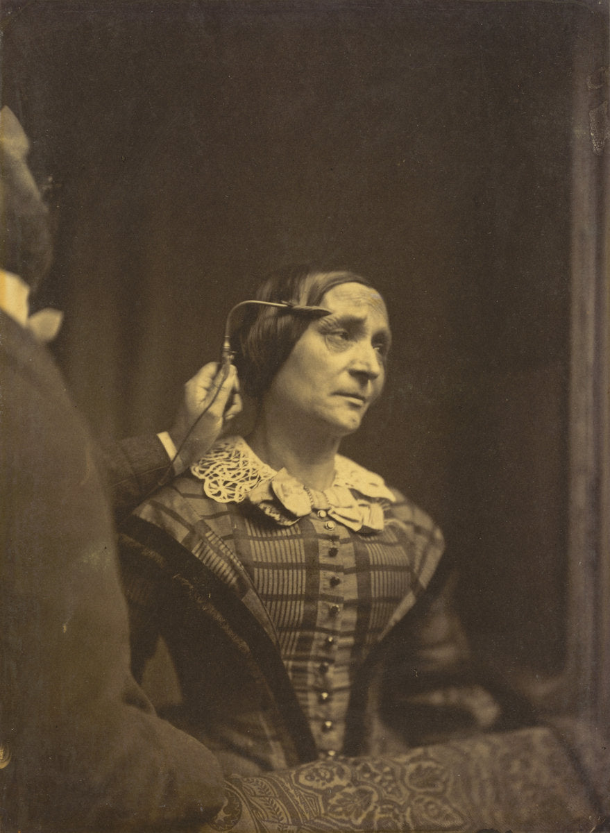 Attention, attentive gaze (left); Painful attention (right) by Guillaume-Benjamin-Amant Duchenne (de Boulogne) (French, 1806 - 1875), 16X12"(A3)Poster Print