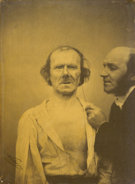 Weeping, tears of pity (left); Relaxed face (right) by Guillaume-Benjamin-Amant Duchenne (de Boulogne) and Adrien Tournachon (French, 1806 - 1875), 16X12"(A3)Poster Print