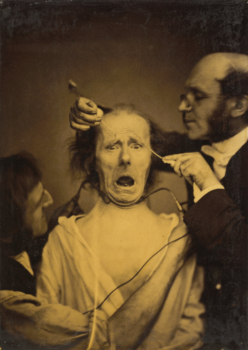 Terror mixed with pain, torture by Guillaume-Benjamin-Amant Duchenne (de Boulogne) (French, 1806 - 1875), 16X12"(A3)Poster Print