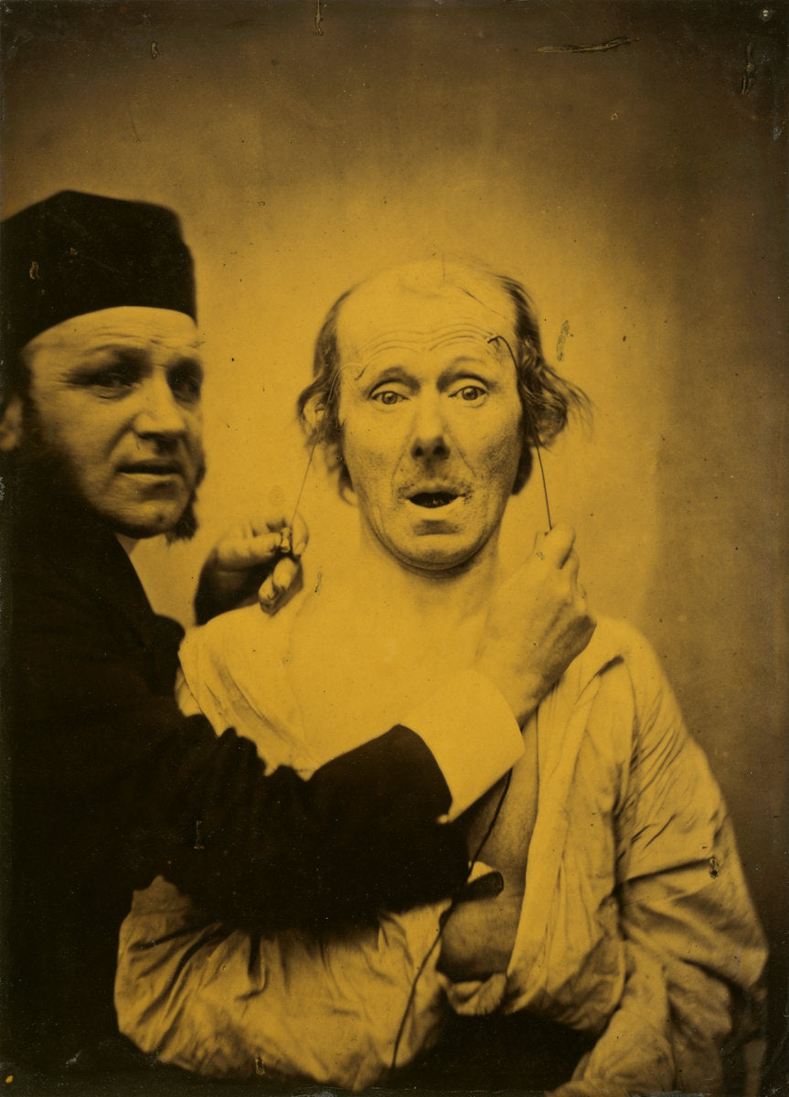 Surprise by Guillaume-Benjamin-Amant Duchenne (de Boulogne) (French, 1806 - 1875), 16X12"(A3)Poster Print
