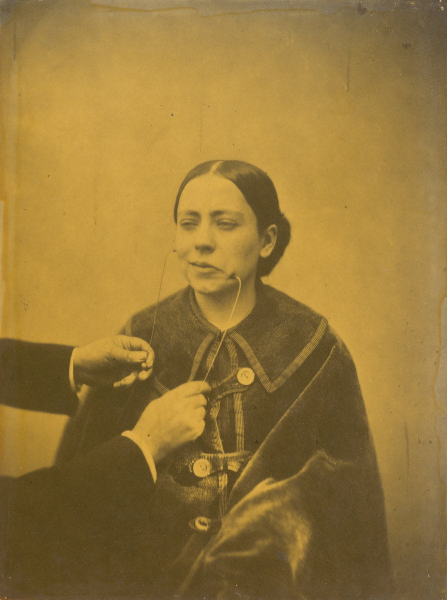 Scornful disgust (left); Scornful laughter (right) by Guillaume-Benjamin-Amant Duchenne (de Boulogne) (French, 1806 - 1875), 16X12"(A3)Poster Print